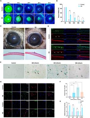 Urolithin A alleviates cell senescence by inhibiting ferroptosis and enhances corneal epithelial wound healing